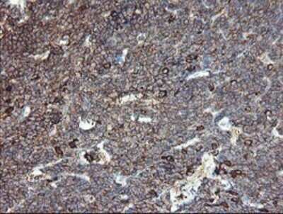 Immunohistochemistry: CLEC4E Antibody (OTI2A8) - Azide and BSA Free [NBP2-71793]