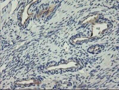 Immunohistochemistry: CLEC4E Antibody (OTI2A8) - Azide and BSA Free [NBP2-71793]