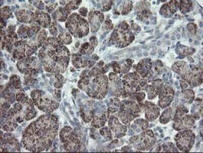 Immunohistochemistry: CLEC4E Antibody (OTI2A8) - Azide and BSA Free [NBP2-71793]