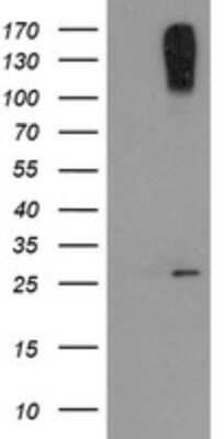 Western Blot: CLEC4E Antibody (OTI2A8)Azide and BSA Free [NBP2-71793]