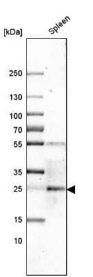 Western Blot: CLEC4E Antibody [NBP2-13844]