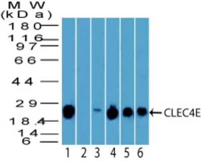 Western Blot: CLEC4E Antibody [NBP2-27093]