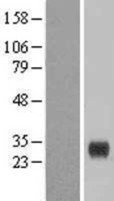 Western Blot: CLEC4E Overexpression Lysate [NBL1-09261]