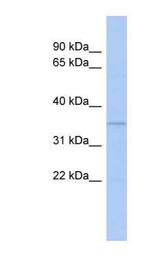 Western Blot: LSECtin/CLEC4G Antibody [NBP1-62196]