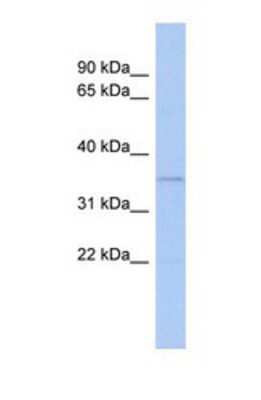 Western Blot: LSECtin/CLEC4G Antibody [NBP1-69237]