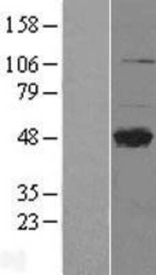 Western Blot: DC-SIGNR/CD299/CLEC4M Overexpression Lysate [NBL1-09262]