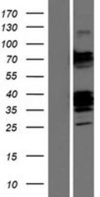 Western Blot: CLEC9a Overexpression Lysate [NBP2-04491]