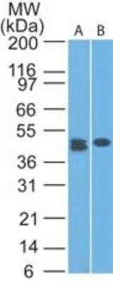 Western Blot: CLEC9a Antibody (14N8D7)Azide and BSA Free [NBP2-80673]