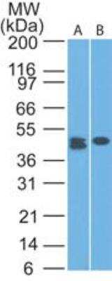 Western Blot: CLEC9a Antibody (14N8D7)BSA Free [NBP2-27087]