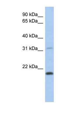 Western Blot: CLECL1 Antibody [NBP1-54397]