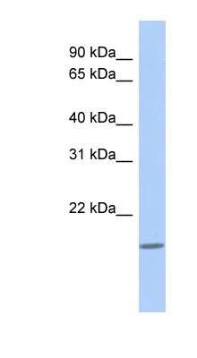 Western Blot: CLECL1 Antibody [NBP1-54968]