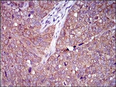 Immunohistochemistry: CLGN Antibody (1C8B6) - BSA Free [NBP2-37348]