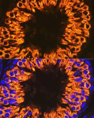 Immunohistochemistry: CLGN Antibody (6U8D7) [NBP3-15836]