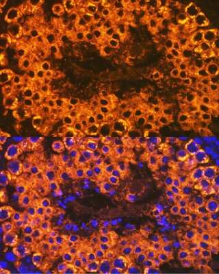 Immunohistochemistry: CLGN Antibody (6U8D7) [NBP3-15836]