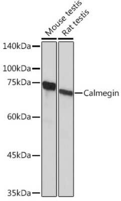 Western Blot: CLGN Antibody (6U8D7) [NBP3-15836]