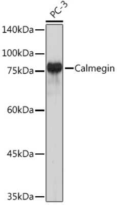 Western Blot: CLGN Antibody (6U8D7) [NBP3-15836]