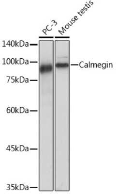 Western Blot: CLGN Antibody (8R8M1) [NBP3-15833]