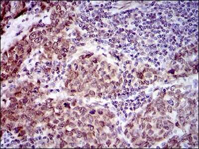 Immunohistochemistry: CLGN Antibody (9C8G10) - BSA Free [NBP2-37395]