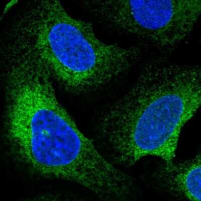 Immunocytochemistry/ Immunofluorescence: CLGN Antibody [NBP2-48915]