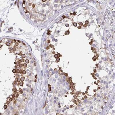 Immunohistochemistry: CLGN Antibody [NBP2-48915]