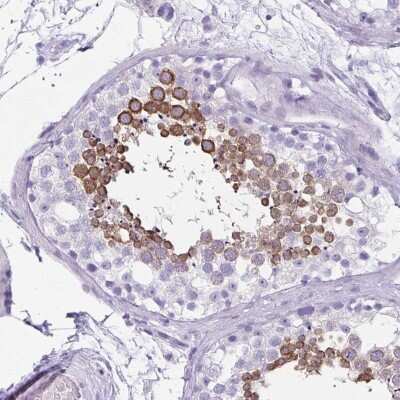 Immunohistochemistry: CLGN Antibody [NBP2-49288]
