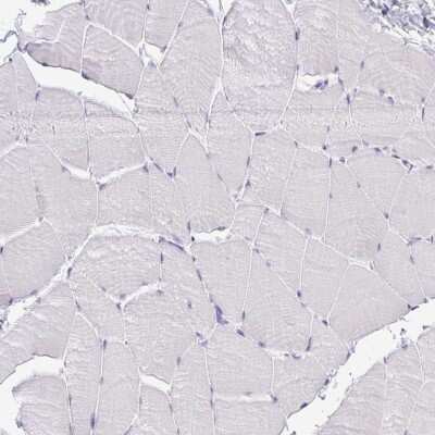 Immunohistochemistry-Paraffin: CLGN Antibody [NBP2-49288]