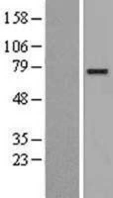 Western Blot: CLGN Overexpression Lysate [NBL1-09265]