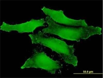 Immunocytochemistry/ Immunofluorescence: CLIC1 Antibody (2D4) [H00001192-M01]