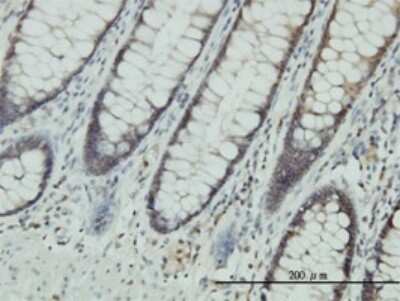 Immunohistochemistry-Paraffin: CLIC1 Antibody (2D4) [H00001192-M01]