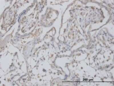 Immunohistochemistry-Paraffin: CLIC1 Antibody (3F9) [H00001192-M02]