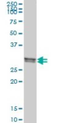 Western Blot: CLIC1 Antibody (3F9) [H00001192-M02]