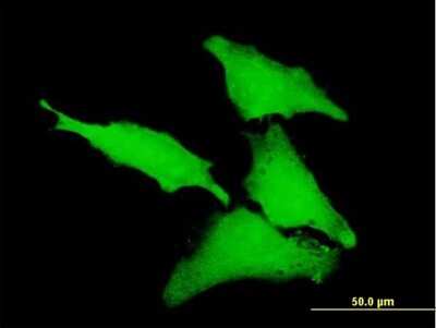 Immunocytochemistry/ Immunofluorescence: CLIC1 Antibody [H00001192-B01P]