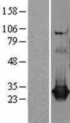 Western Blot: CLIC1 Overexpression Lysate [NBL1-09266]