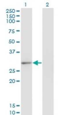 Western Blot: CLIC2 Antibody (2C1) [H00001193-M01]