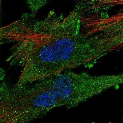 Immunocytochemistry/ Immunofluorescence: CLIC2 Antibody [NBP2-54982]