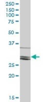 Western Blot: CLIC2 Antibody [H00001193-B02P]