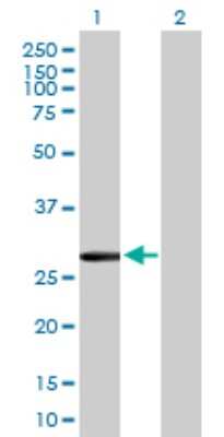 Western Blot: CLIC2 Antibody [H00001193-B02P]