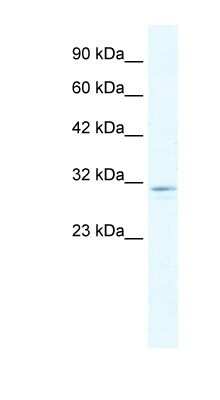 Western Blot: CLIC2 Antibody [NBP1-80058]