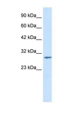 Western Blot: CLIC2 Antibody [NBP1-80059]