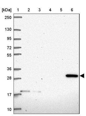 Western Blot: CLIC2 Antibody [NBP2-32516]