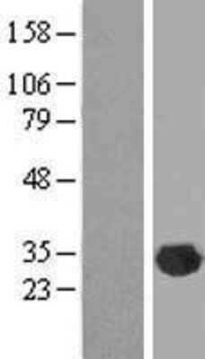 Western Blot: CLIC2 Overexpression Lysate [NBL1-09267]