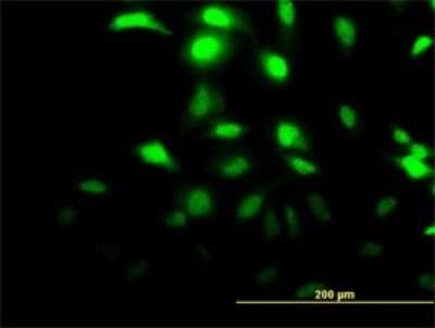 Immunocytochemistry/ Immunofluorescence: CLIC3 Antibody (3F8) [H00009022-M02]