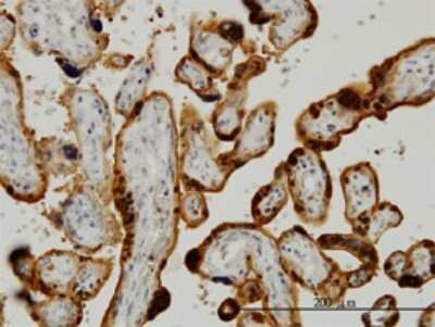 Immunohistochemistry-Paraffin: CLIC3 Antibody (3F8) [H00009022-M02]