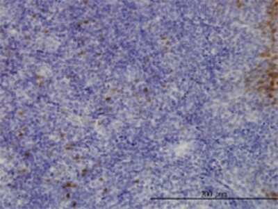 Immunohistochemistry-Paraffin: CLIC3 Antibody (3F8) [H00009022-M02]