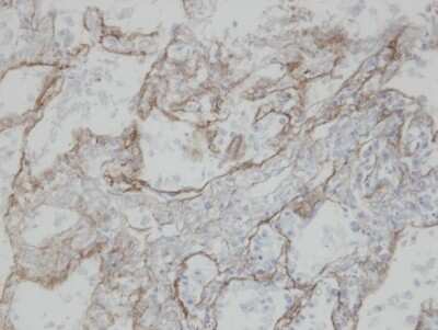 Immunohistochemistry-Paraffin: CLIC3 Antibody [NBP1-31438]
