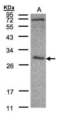 Western Blot: CLIC3 Antibody [NBP1-31438]