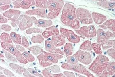 Immunohistochemistry-Paraffin: CLIC4 Antibody [NBP1-00172]