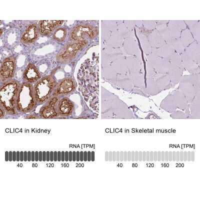 Immunohistochemistry-Paraffin: CLIC4 Antibody [NBP1-85574]