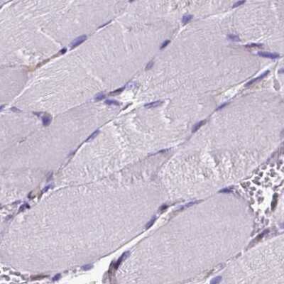 Immunohistochemistry-Paraffin: CLIC4 Antibody [NBP2-49321]