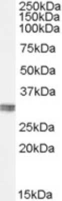 Western Blot: CLIC4 Antibody [NBP1-00172]